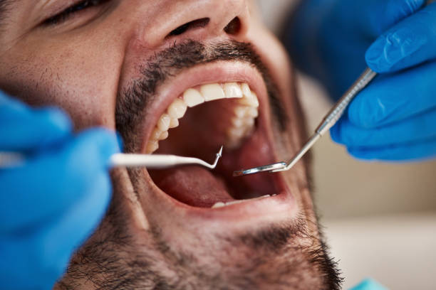 Best Root Canal Treatment  in Fabrica, TX